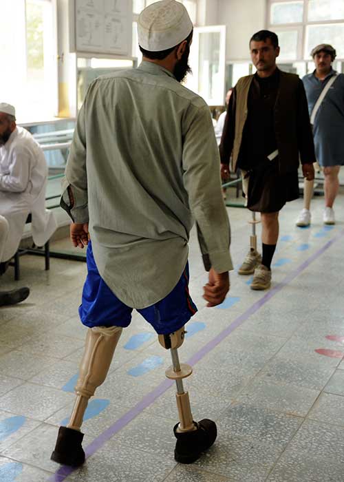 Three men with landmine injuries practice walking on their prosthetic legs